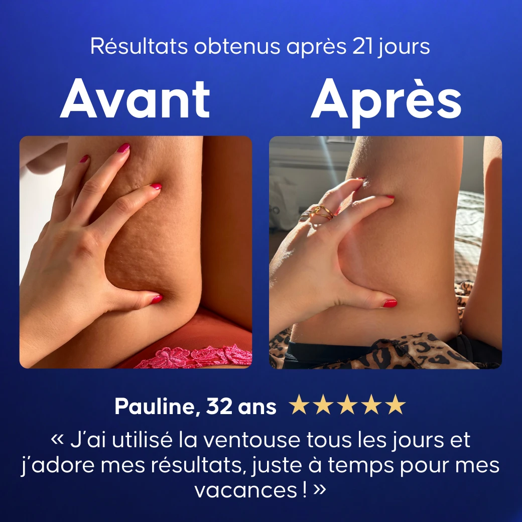 Ventouse Cellulite Électrique Connectée - 10