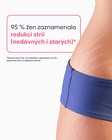 Nanášení oleje na strie Cellublue na břicho