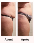 Texture du soin minceur ventre Programme Cellublue