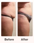 Cellublue slimming pack lifestyle shot smooth and toned skin
