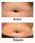 Pack maxi antiestrias Cellublue com creme reparador intensivo