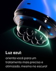 Resultados antes e depois com aparelho anticelulite Cellublue