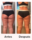 Resultados visibles con el Pack Maxi Celulitis Cellublue