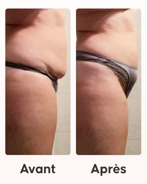 Cellcup ventouse anti-cellulite utilisée avec le programme minceur