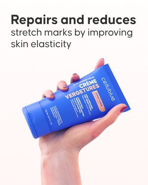Stretch Mark Repair Cream texture and consistency close-up