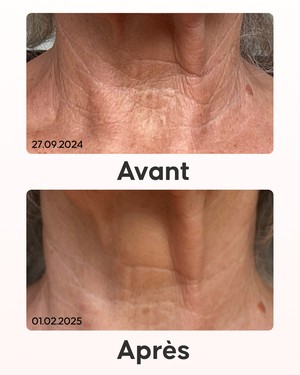 Slider Pack Maxi Raffermissant Cellublue routine complète