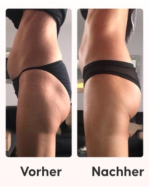 21-Tage-Coaching-Programm der Cellublue Anti-Cellulite-Methode