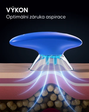 Filtry s přísavkami proti celulitidě - 4