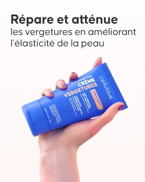 Slide application crème vergetures sur vergetures blanches