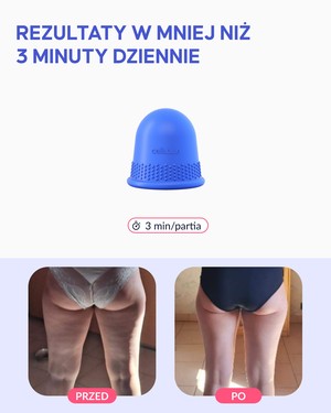 Bańka antycellulitowa - 4