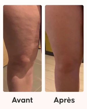 Application du soin anti-cellulite nuit programme Cellublue