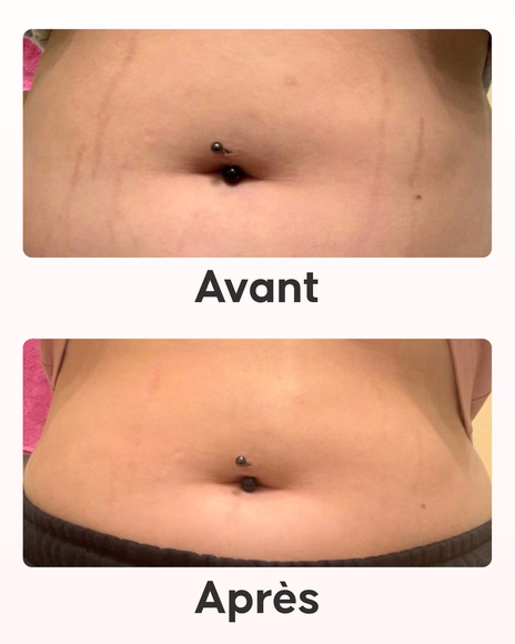 Texture des soins du Pack Maxi Vergetures Cellublue