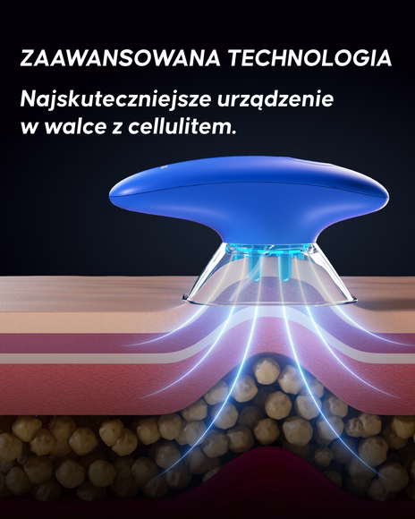 Zastosowanie elektrycznej bańki Cellublue na udach