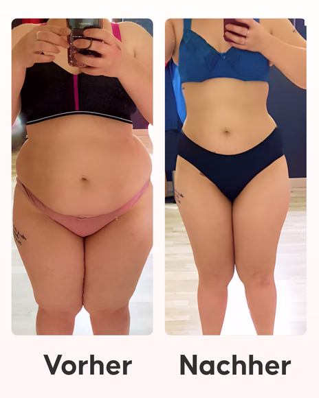 Cellublue Schlankheitsgerät Massagefunktion Anwendungsschritte