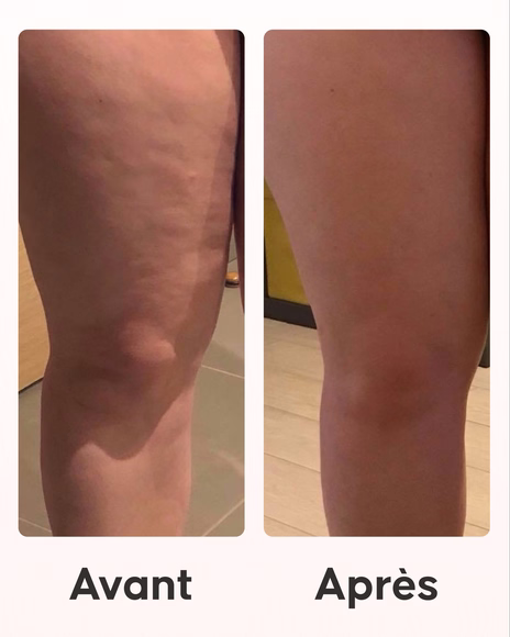 Gua Sha Corps Cellublue utilisé pour le massage drainant