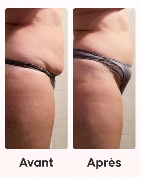 Cellcup ventouse anti-cellulite utilisée avec le programme minceur