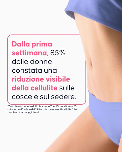 Applicazione della ventosa CellCup sulla coscia