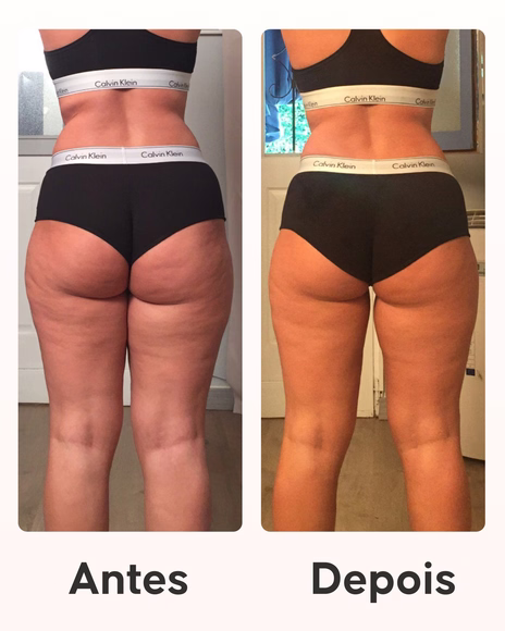 Detalhe dos ingredientes ativos do Pack Maxi Cellublue