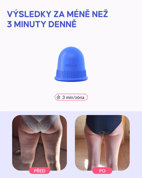 Vakuová baňka na celulitidu - 4