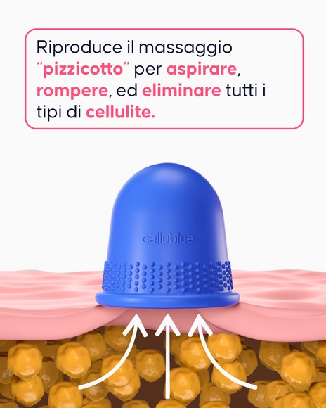 Risultati trattamento anticellulite con CellCup Cellublue
