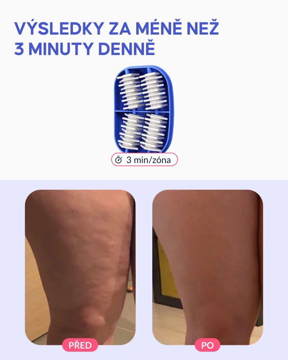 Masážní váleček na pomerančovou kůži