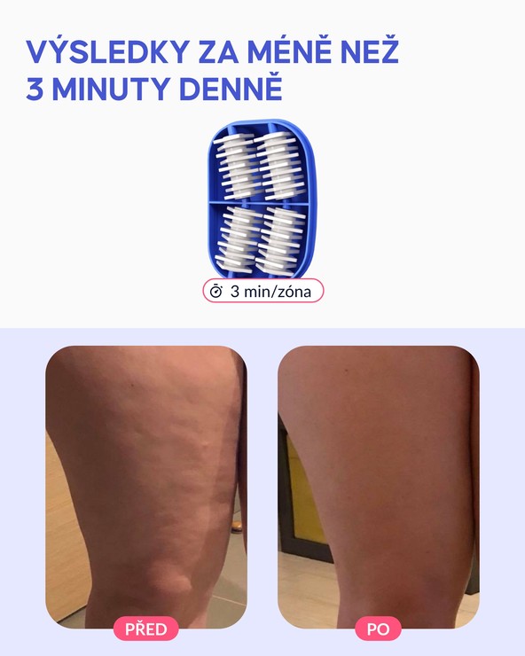 Masážní váleček na pomerančovou kůži