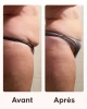 Cellcup ventouse anti-cellulite utilisée avec le programme minceur