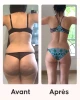 Routine complète minceur cuisses avec les soins Cellublue