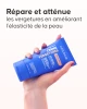 Slide application crème vergetures sur vergetures blanches
