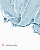 Zeštíhlující cryo gel na břicho - 5