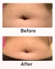 Cellublue stretch mark repair full routine products overview