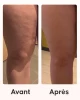 Application du soin anti-cellulite nuit programme Cellublue