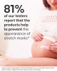 Before and after results using Cellublue anti-stretch mark kit