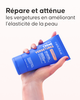 Slide application crème vergetures sur vergetures blanches