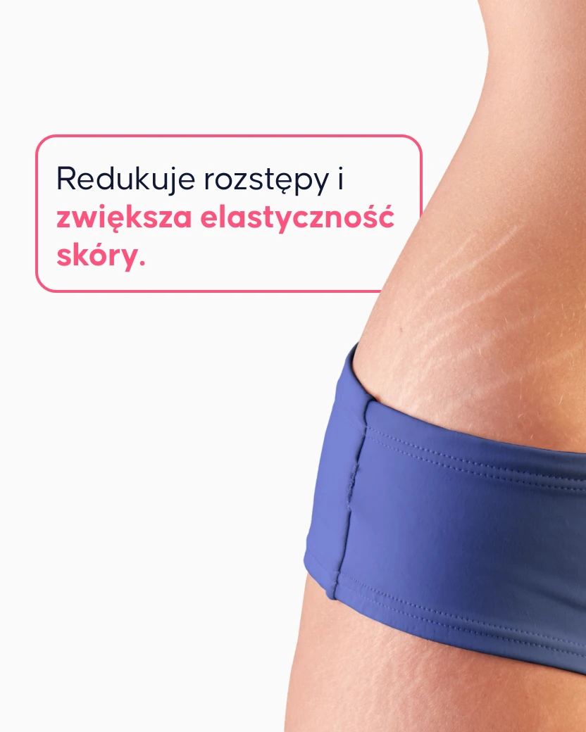 Regenerujący krem na rozstępy - 2