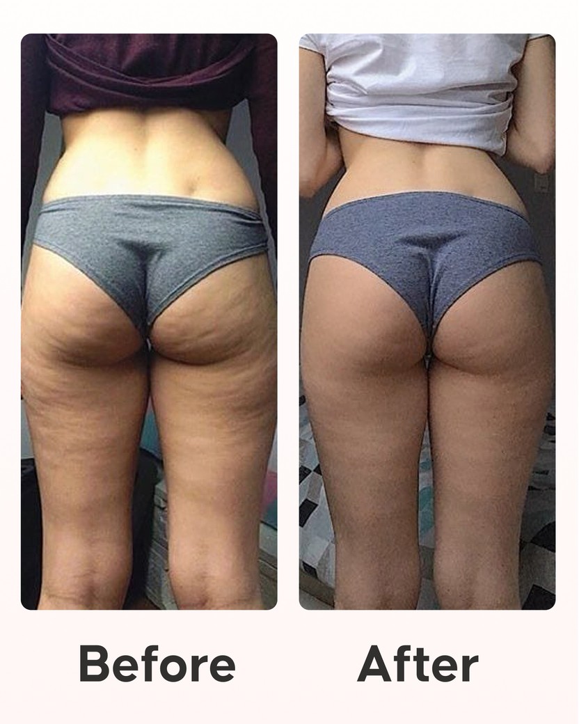 Anti-Cellulite Expert Pack step-by-step usage guide