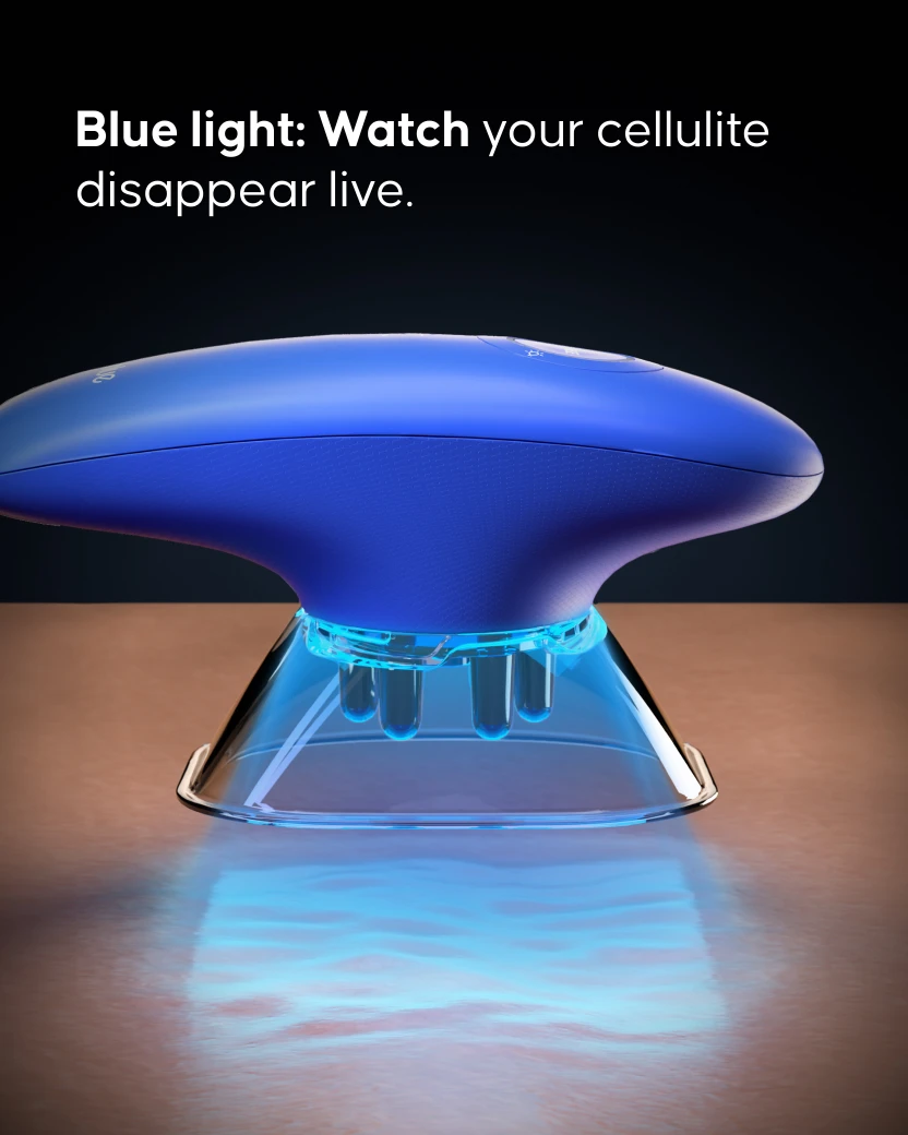Cellublue electric cupping device smoothing orange peel skin