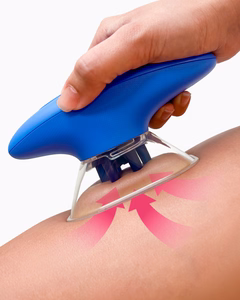 Ventouse Anti-Cellulite Électrique