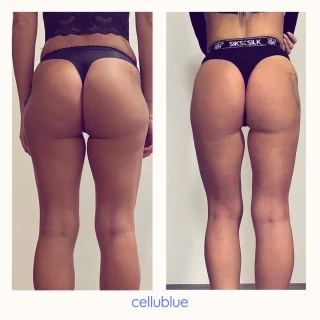 Before/After