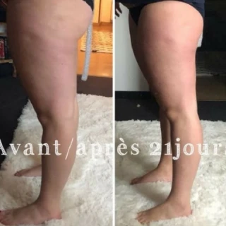 Before/After
