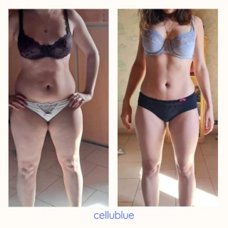Before/After