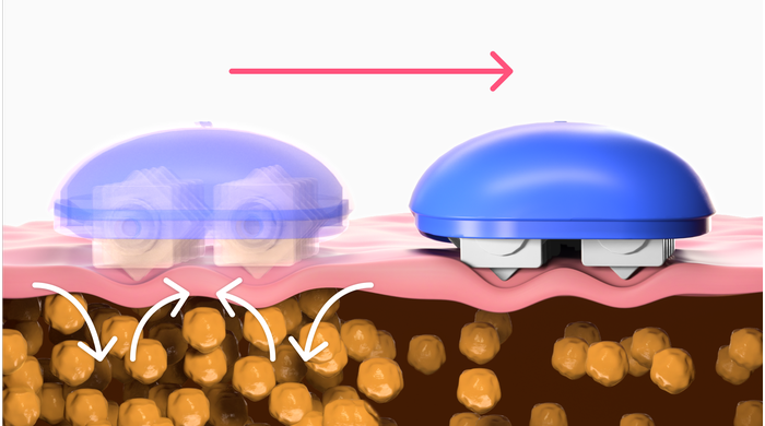 Agit par pétrissage