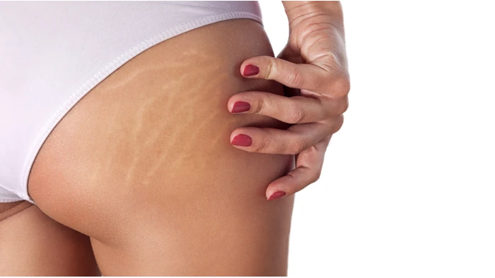 Massage rapide et facile