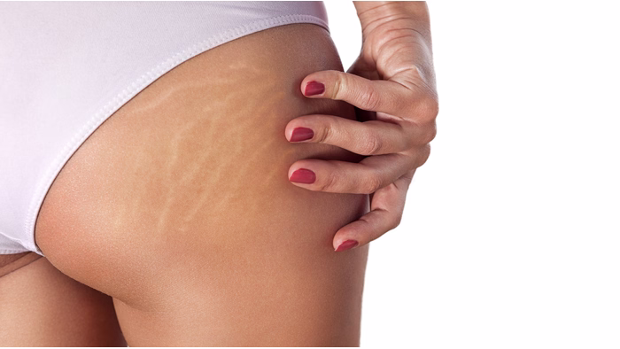 Massage rapide et efficace